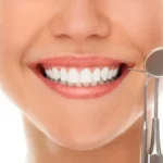 Effective Ways to Maintain Your Bright Smile After Whitening