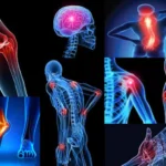 How Regenerative Medicine Helps Reduce Chronic Joint Pain Among Residents in Allentown